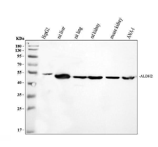 Anti-ALDH2 Antibody Picoband® Boster Bio