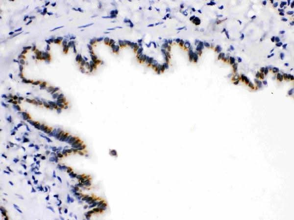 Anti-ARSA Antibody Picoband® Boster Bio
