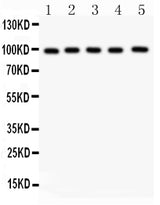 Anti-Aspartate beta hydroxylase/ASPH Antibody Picoband® Boster Bio