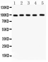 Anti-Aspartate beta hydroxylase/ASPH Antibody Picoband® Boster Bio