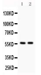 Anti-KIAA0652/ATG13 Antibody Picoband® Boster Bio