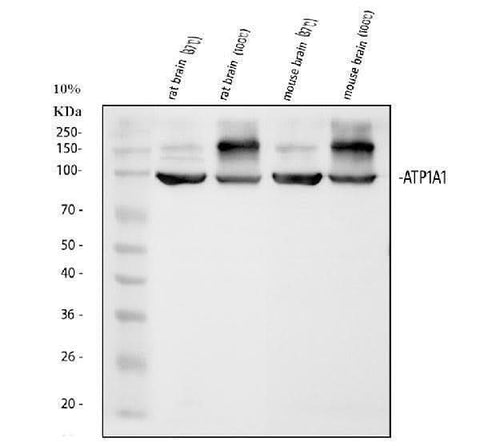 Anti-alpha 1 Sodium Potassium ATPase/ATP1A1 Antibody Picoband® Boster Bio