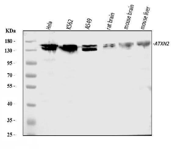 Anti-ATX2/ATXN2 Antibody Picoband® Boster Bio