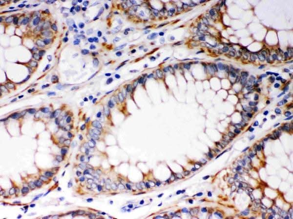 Anti-BAK/BAK1 Antibody Picoband® Boster Bio