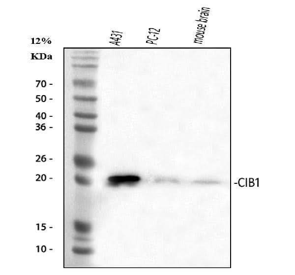 Anti-CIB1 Antibody Picoband® Boster Bio