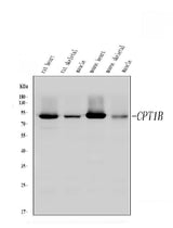 Anti-CPT1B Antibody Picoband® Boster Bio