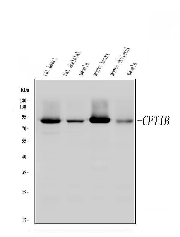 Anti-CPT1B Antibody Picoband® Boster Bio