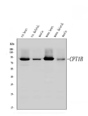 Anti-CPT1B Antibody Picoband® Boster Bio