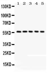 Anti-CREB3L1 Antibody Picoband® Boster Bio