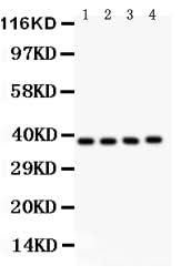 Anti-PINX1 Antibody Picoband® Boster Bio