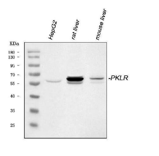 Anti-PKLR Antibody Picoband® Boster Bio