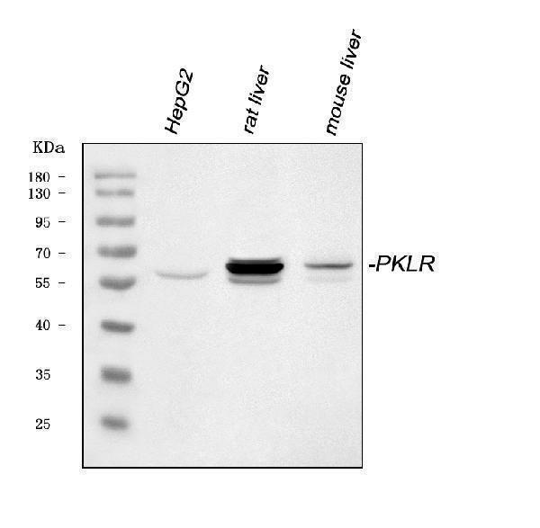Anti-PKLR Antibody Picoband® Boster Bio