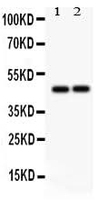 Anti-TCPTP/PTPN2 Antibody Picoband® Boster Bio