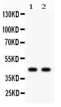Anti-alpha Sarcoglycan/SGCA Antibody Picoband® Boster Bio