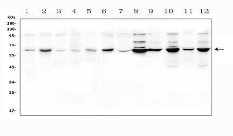 Anti-SLC19A1 Antibody Picoband® Boster Bio