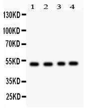 Anti-SOCS4 Antibody Picoband® Boster Bio