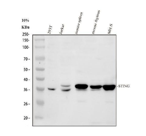 Anti-TMEM173 Antibody Picoband® Boster Bio