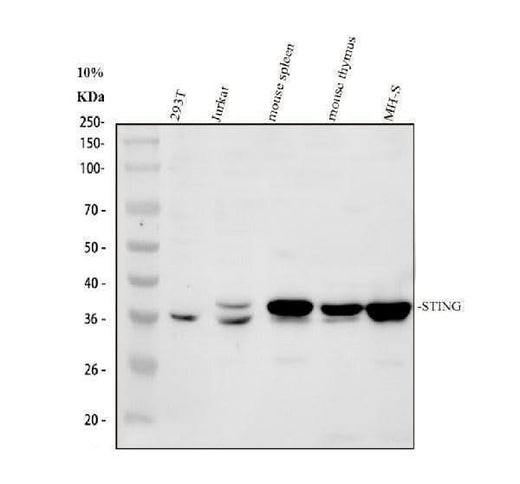 Anti-TMEM173 Antibody Picoband® Boster Bio