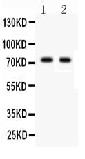 Anti-TNF Receptor II/TNFRSF1B Antibody Picoband® Boster Bio