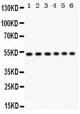 Anti-ULK3 Antibody Picoband® Boster Bio