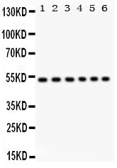 Anti-ULK3 Antibody Picoband® Boster Bio