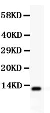 Anti-Estrogen Inducible Protein pS2/TFF1 Antibody Picoband® Boster Bio