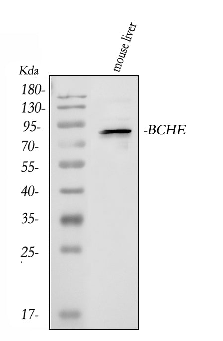 Anti-Butyrylcholinesterase/BCHE Antibody Picoband® Boster Bio