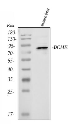 Anti-Butyrylcholinesterase/BCHE Antibody Picoband® Boster Bio