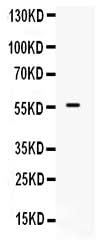 Anti-BMPR1B Antibody Picoband® Boster Bio