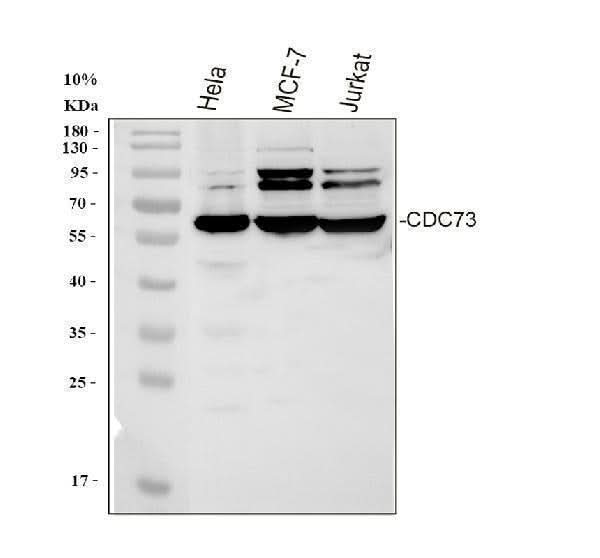 Anti-HRPT2/CDC73 Antibody Picoband® Boster Bio
