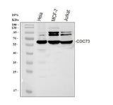 Anti-HRPT2/CDC73 Antibody Picoband® Boster Bio