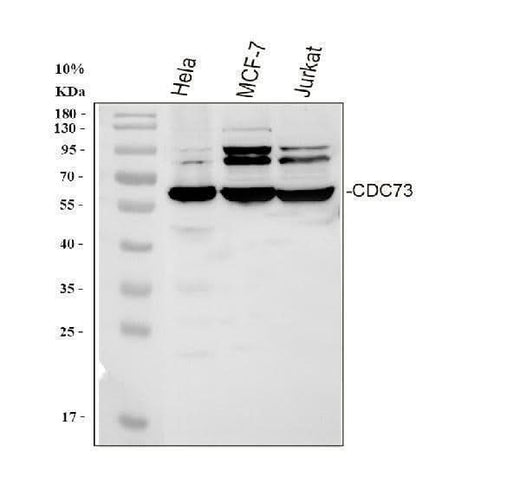 Anti-HRPT2/CDC73 Antibody Picoband® Boster Bio