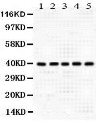 Anti-Cdk7 Antibody Picoband® Boster Bio