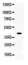 Anti-Cdk9 Antibody Picoband® Boster Bio