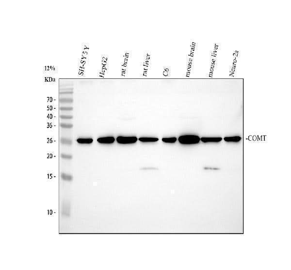 Anti-COMT Antibody Picoband® Boster Bio