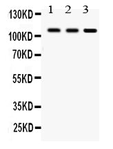 Anti-CYLD Antibody Picoband® Boster Bio
