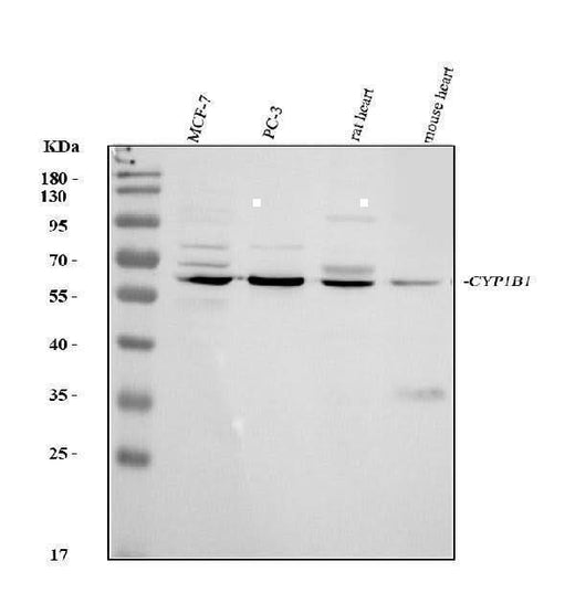 Anti-CYP1B1 Antibody Picoband® Boster Bio