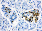 Anti-CYP24A1 Antibody Picoband® Boster Bio