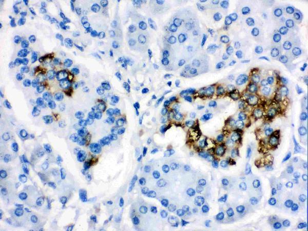 Anti-CYP24A1 Antibody Picoband® Boster Bio