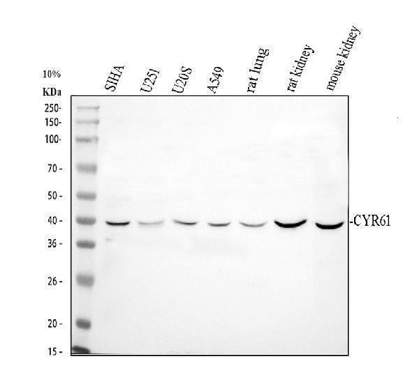 Anti-CCN1/CYR61 Antibody Picoband® Boster Bio