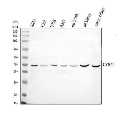 Anti-CCN1/CYR61 Antibody Picoband® Boster Bio