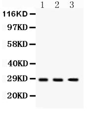 Anti-DKK2 Antibody Picoband® Boster Bio