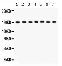 Anti-SAP97/DLG1 Antibody Picoband® Boster Bio