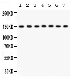 Anti-SAP97/DLG1 Antibody Picoband® Boster Bio