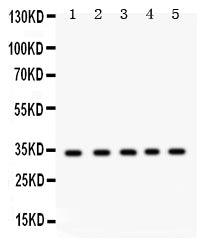 Anti-EBAG9 Antibody Picoband® Boster Bio