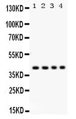 Anti-Parvin alpha/PARVA Antibody Picoband® Boster Bio