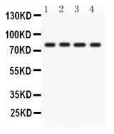 Anti-PKC eta/PRKCH Antibody Picoband® Boster Bio