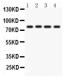 Anti-PKC eta/PRKCH Antibody Picoband® Boster Bio