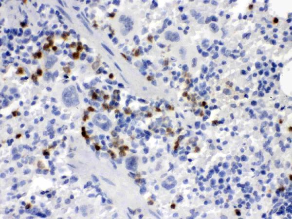 Anti-MCSF/CSF1 Antibody Boster Bio