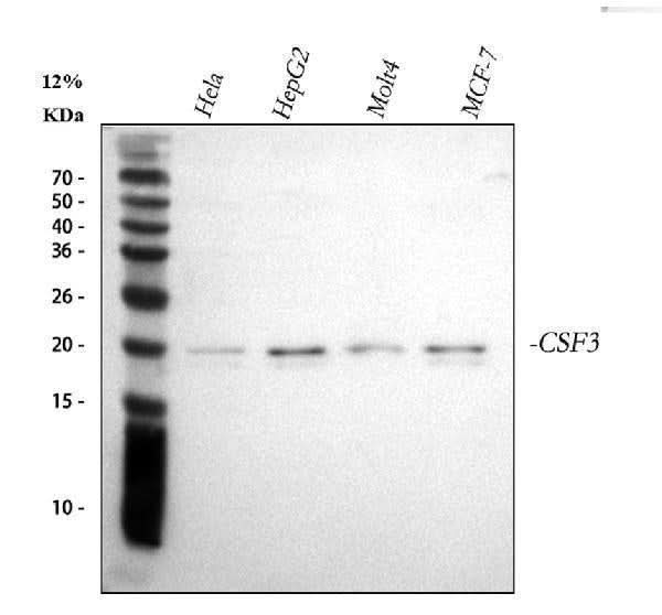 Anti-G-CSF/CSF3 Antibody Picoband® Boster Bio